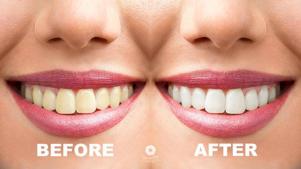 The Simple Way To Whiten Teeth In Photoshop - CiprianFOTO | Photoshop ...